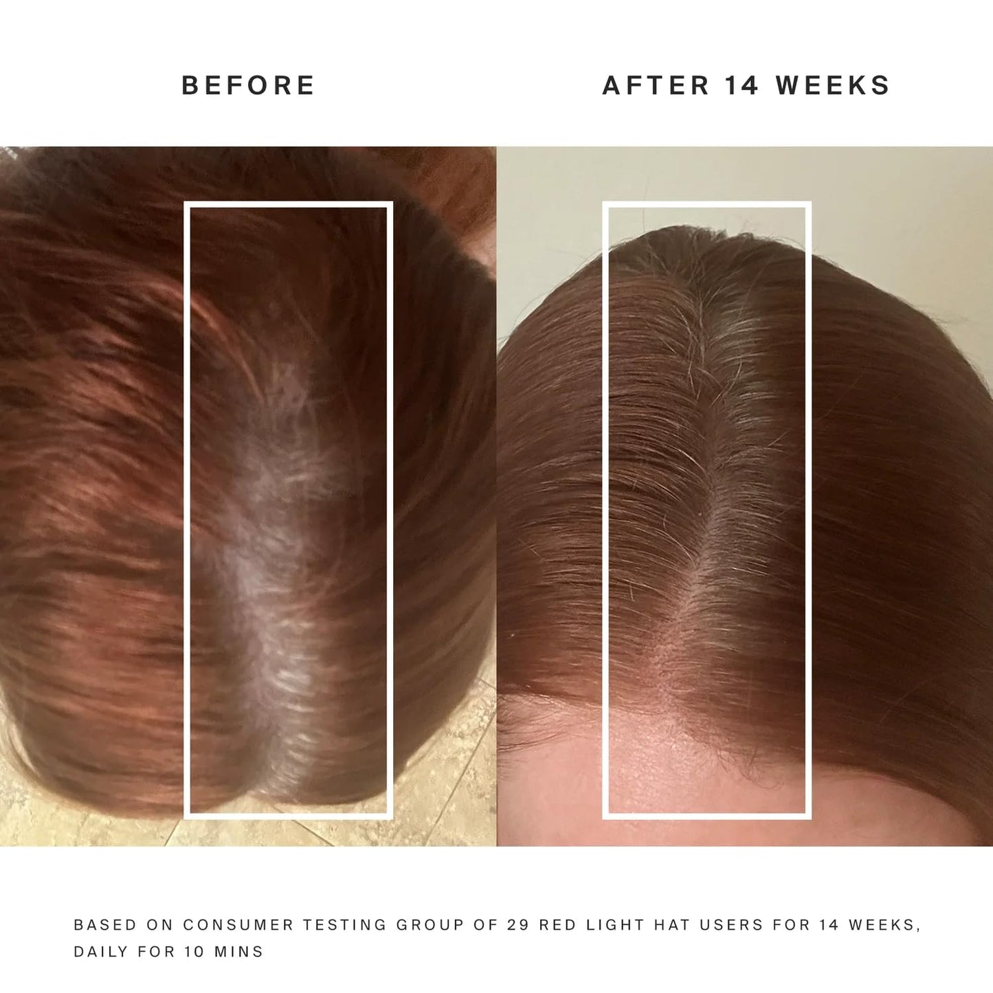 Misonlueur Hair Regrowth & Therapy Cap